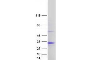 Western Blotting (WB) image for ChaC, Cation Transport Regulator Homolog 1 (CHAC1) (Transcript Variant 2) protein (Myc-DYKDDDDK Tag) (ABIN2713952)