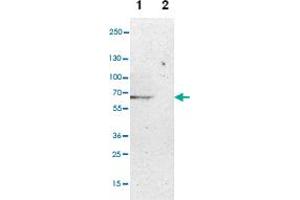 Western blot anyalysis of Lane 1: NIH-3T3 cell lysate (Mouse embryonic fibroblast cells), Lane 2: NBT-II cell lysate (Rat Wistar bladder tumour cells) with CPM polyclonal antibody . (CPM 抗体)