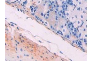 Detection of MYLK in Mouse Stomach Tissue using Polyclonal Antibody to Myosin Light Chain Kinase (MYLK) (MYLK 抗体  (AA 1684-1884))