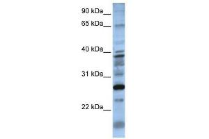 DOLPP1 antibody used at 1 ug/ml to detect target protein. (DOLPP1 抗体  (N-Term))