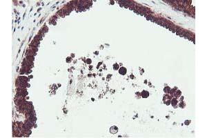 Immunohistochemical staining of paraffin-embedded Human breast tissue using anti-EPN2 mouse monoclonal antibody. (Epsin 2 抗体)