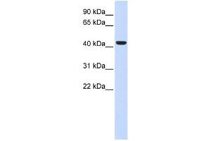 BACE1 antibody used at 1 ug/ml to detect target protein. (BACE1 抗体  (N-Term))