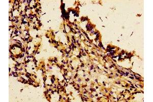 Immunohistochemistry of paraffin-embedded human lung tissue using ABIN7156829 at dilution of 1:100 (IL18R1 抗体  (AA 22-128))