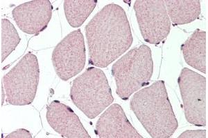 Human, Skeletal muscle: Formalin-Fixed Paraffin-Embedded (FFPE)