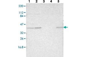 Western blot analysis of Lane 1: RT-4, Lane 2: U-251 MG, Lane 3: Human Plasma, Lane 4: Liver, Lane 5: Tonsil with MAFB polyclonal antibody  at 1:250-1:500 dilution. (MAFB 抗体)