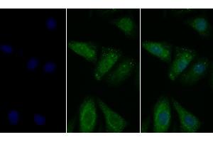 Detection of PDL1 in Human Hela cell using Polyclonal Antibody to Programmed Cell Death Protein 1 Ligand 1 (PDL1) (PD-L1 抗体  (AA 24-234))