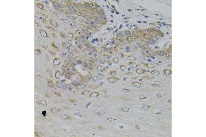 Immunohistochemistry of paraffin-embedded human esophagus using IRF1 antibody. (IRF1 抗体)