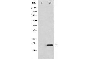 Western blot analysis of 4E-BP1 expression in EGF treated MDA-MB-435 whole cell lysates,The lane on the left is treated with the antigen-specific peptide.
