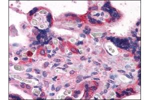 Immunohistochemistry Image: Human Placenta: Formalin-Fixed, Paraffin-Embedded (FFPE) (BAG3 抗体  (C-Term))