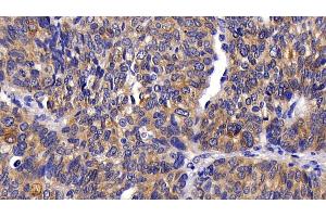 Immunohistochemistry (IHC) image for anti-V-Akt Murine Thymoma Viral Oncogene Homolog 1 (AKT1) (AA 122-443) antibody (ABIN7439390)