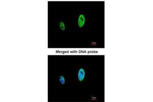 ICC/IF Image Immunofluorescence analysis of paraformaldehyde-fixed HeLa, using TIMELESS, antibody at 1:500 dilution. (TIMELESS 抗体  (N-Term))