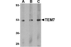 Image no. 1 for anti-Plexin Domain Containing 1 (PLXDC1) (C-Term) antibody (ABIN203738) (PLXDC1 抗体  (C-Term))