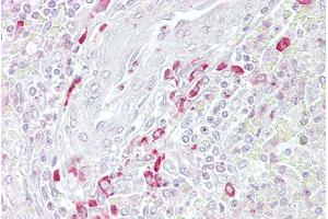 Immunohistochemistry with Spleen tissue at an antibody concentration of 5µg/ml using anti-FRZB antibody (ARP54571_P050) (FRZB 抗体  (Middle Region))