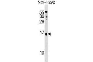 Western Blotting (WB) image for anti-Selenoprotein M (SELM) antibody (ABIN3001336) (SELM 抗体)