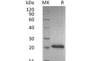 Western Blotting (WB) image for Metalloproteinase Inhibitor 2 (TIMP2) protein (His tag) (ABIN7320661)