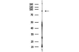 Western blot analysis of lysates from MDA-MB-231 cells(heat-shock,45 min treatment), using CDH16 Antibody at 1/1000 dilution.