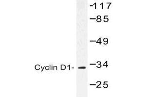Western blot (WB) analysis of Cyclin D1 antibody in extracts from K562 cells. (Cyclin D1 抗体)