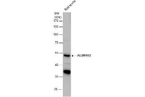 WB Image ALDH1A2 antibody detects ALDH1A2 protein by western blot analysis. (ALDH1A2 抗体)