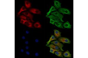 Phospho-EPRS (Ser886) Antibody staining Hela cells(heat shock treatment) by IF/ICC. (EPRS 抗体  (pSer886))