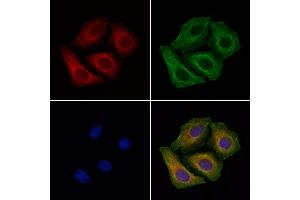 ABIN6265800 and ABIN6266909 staining Hela cells by IF/ICC. (TUBGCP5 抗体  (Internal Region))