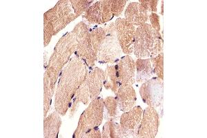 Immunohistochemical analysis of paraffin-embedded H. (CARD6 抗体  (AA 755-787))