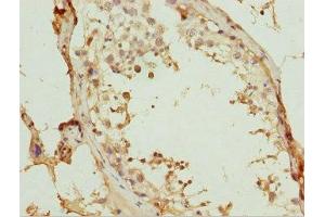 Immunohistochemistry of paraffin-embedded human testis tissue using ABIN7175755 at dilution of 1:100 (WDR47 抗体  (AA 350-600))