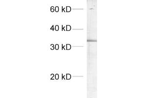 dilution: 1 : 1000, sample: crude synaptosomal fraction of rat brain (P2) (SCAMP1 抗体  (AA 2-15))