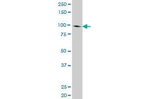 NBN monoclonal antibody (M01), clone 3E4 Western Blot analysis of NBN expression in HL-60 . (Nibrin 抗体  (AA 645-754))