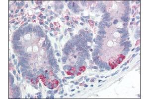 Image no. 1 for anti-Prolyl 4-Hydroxylase, beta Polypeptide (P4HB) antibody (ABIN372745)