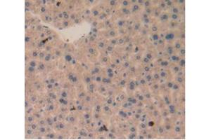 Immunohistochemistry (Paraffin-embedded Sections) (IHC (p)) image for anti-CD274 (PD-L1) (AA 34-241) antibody (ABIN2921662)
