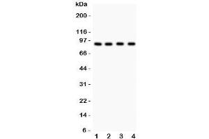 Western blot testing of Furin antibody and Lane 1:  HeLa;  2: MCF-7;  3: COLO320;  4: SW620. (FURIN 抗体  (AA 591-794))