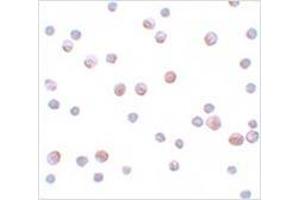 Immunocytochemistry of SIP1 in HeLa cells with SIP1 antibody at 4 μg/ml. (SIP1 抗体  (C-Term))