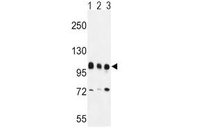 Western Blotting (WB) image for anti-Enhancer of Zeste Homolog 2 (EZH2) antibody (ABIN3001535) (EZH2 抗体)