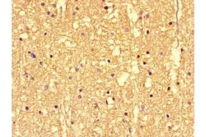 Immunohistochemistry of paraffin-embedded human brain tissue using ABIN7146400 at dilution of 1:100 (SS18L1 抗体  (AA 47-396))