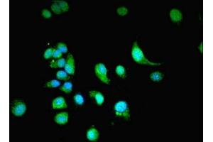 Immunofluorescent analysis of MCF-7 cells using ABIN7161936 at dilution of 1:100 and Alexa Fluor 488-congugated AffiniPure Goat Anti-Rabbit IgG(H+L) (NXF3 抗体  (AA 1-531))