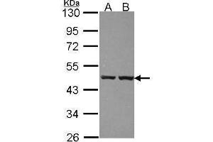 WB Image Sample (30 ug of whole cell lysate) A: 293T B: A431 , 10% SDS PAGE antibody diluted at 1:1000 (ZNF396 抗体)