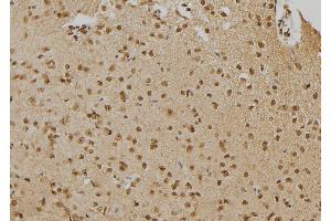 Immunohistochemistry (IHC) image for anti-Tyrosine-Protein Phosphatase Non-Receptor Type 22 (PTPN22) (C-Term) antibody (ABIN6264518)