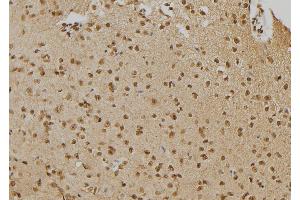 ABIN6276672 at 1/100 staining Mouse brain tissue by IHC-P. (PTPN22 抗体  (C-Term))