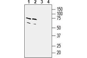 Western blot analysis of mouse (lanes 1 and 3) and rat (lanes 2 and 4) brain lysates: - 1,2. (TBXA2R 抗体  (3rd Intracellular Loop))
