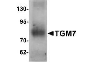 Western blot analysis of TGM7 in human lung tissue lysate with TGM7 Antibody  at 1 μg/ml. (Transglutaminase 7 抗体  (Middle Region))