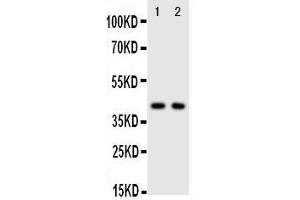 Anti-CXCR5 antibody, Western blotting Lane 1: Rat Spleen Tissue Lysate Lane 2: HELA Cell Lysate (CXCR5 抗体  (C-Term))