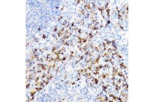 Immunohistochemistry of paraffin-embedded mouse spleen using YKL-40/CHI3L1 antibody (ABIN3022444, ABIN3022445, ABIN3022446 and ABIN6218823) at dilution of 1:100 (40x lens).