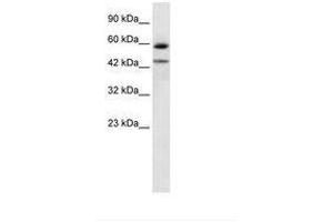 Image no. 1 for anti-Thyroid Hormone Receptor, alpha (THRA) (AA 246-295) antibody (ABIN6735941) (THRA 抗体  (AA 246-295))