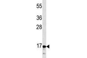 CGRP antibody western blot analysis in CEM lysate (CGRP 抗体  (AA 56-84))