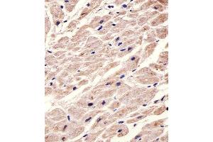 Immunohistochemistry (Paraffin-embedded Sections) (IHC (p)) image for anti-Cholinergic Receptor, Muscarinic 2 (CHRM2) antibody (ABIN6242476)