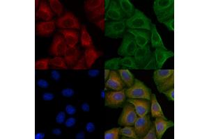 ABIN6256507 and ABIN6267633 staining H2O2 treated Hela cells by IF/ICC. (PAK1 抗体  (pThr212))