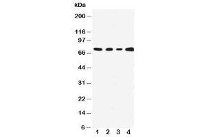 Western blot testing with MEKK3 antibody;  Lane 1: HeLa;  2: A431;  3: MCF-7;  4: Jurkat cell lysate. (MAP3K3 抗体  (N-Term))