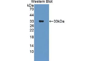 Western blot analysis of the recombinant protein. (ERBB3 抗体  (AA 707-964))