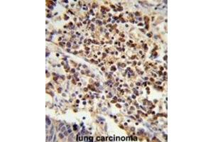 Immunohistochemistry (IHC) image for anti-U2 Small Nuclear RNA Auxiliary Factor 1 (U2AF1) antibody (ABIN3001639) (U2AF1 抗体)