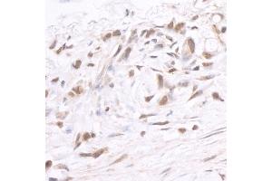Immunohistochemistry (IHC) image for anti-Bromodomain Containing 2 (BRD2) (AA 675-725) antibody (ABIN7448918)